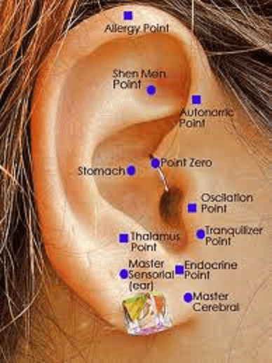 ear acupuncture